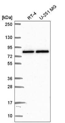 Western Blot: PABPC4 Antibody [NBP2-58575]