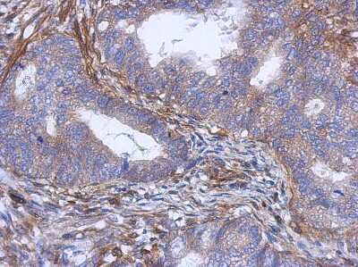 Immunohistochemistry-Paraffin: PABPC5 Antibody [NBP2-19672]