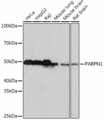 Western Blot: PABPN1 Antibody (7V4X8) [NBP3-15539]