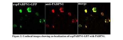 Immunocytochemistry/ Immunofluorescence: PABPN1 Antibody [NBP1-57216]