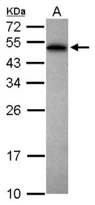 Western Blot: PABPN1 Antibody [NBP1-31805]