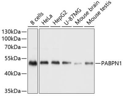 Western Blot: PABPN1 AntibodyBSA Free [NBP2-93664]