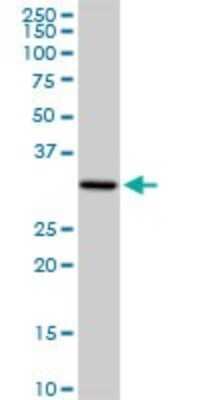 Western Blot: PACRG Antibody [H00135138-D01P]