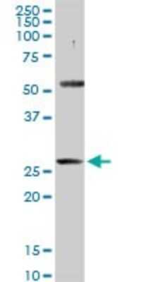 Western Blot: PACRG Antibody [H00135138-D01P]