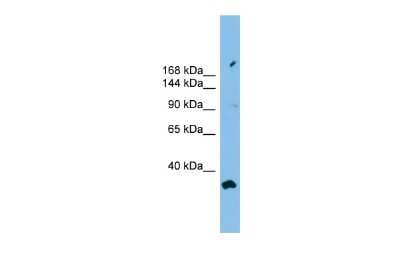 Western Blot: PACS2 Antibody [NBP2-85435]