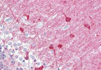 Immunohistochemistry-Paraffin: PACSIN1 Antibody [NB100-861]