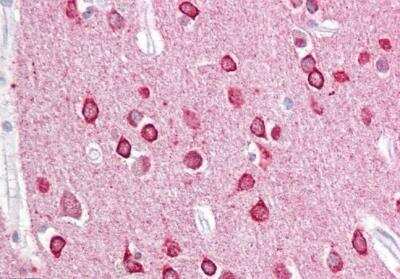 Immunohistochemistry-Paraffin: PACSIN1 Antibody [NB100-861]