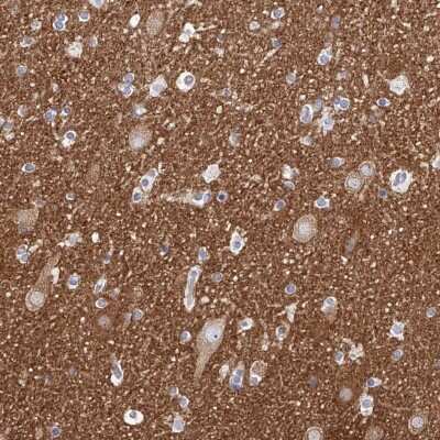 Immunohistochemistry-Paraffin: PACSIN1 Antibody [NBP1-87067]
