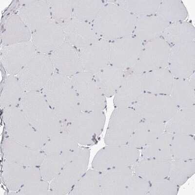 Immunohistochemistry-Paraffin: PACSIN1 Antibody [NBP1-87067]