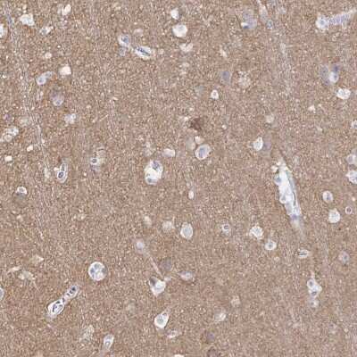 Immunohistochemistry-Paraffin: PACSIN1 Antibody [NBP2-33756]