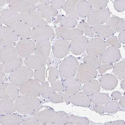 Immunohistochemistry-Paraffin: PACSIN1 Antibody [NBP2-33756]