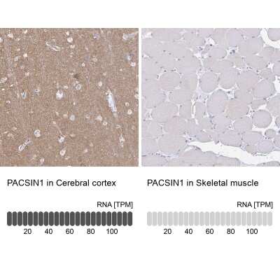 Immunohistochemistry-Paraffin: PACSIN1 Antibody [NBP2-33756]