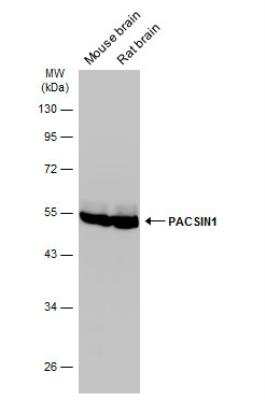 Western Blot: PACSIN1 Antibody [NBP1-32324]