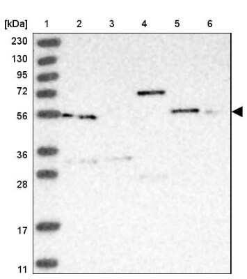 Western Blot: PACSIN1 Antibody [NBP1-87067]