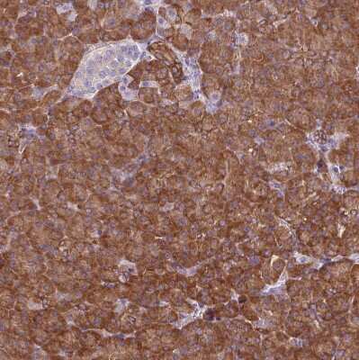 Immunohistochemistry-Paraffin: PACSIN2 Antibody [NBP2-13723]