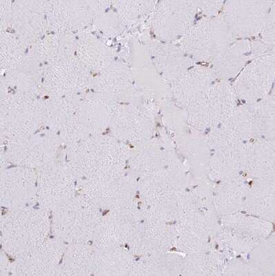 Immunohistochemistry-Paraffin: PACSIN2 Antibody [NBP2-13723]