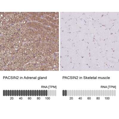 Immunohistochemistry-Paraffin: PACSIN2 Antibody [NBP2-13723]