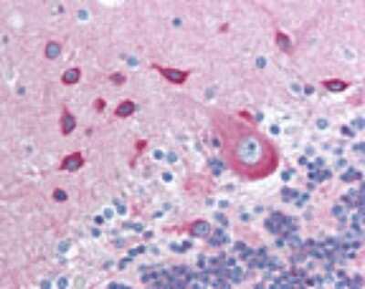 Immunohistochemistry-Paraffin: PACSIN2 Antibody [NBP2-24481]