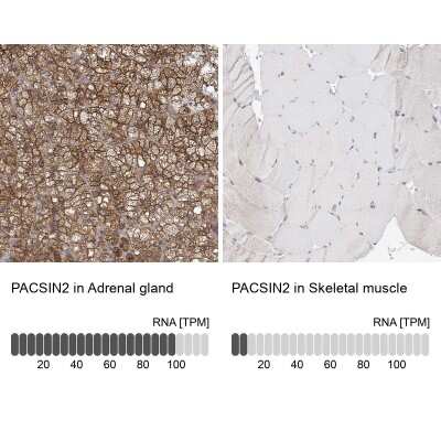 Immunohistochemistry-Paraffin: PACSIN2 Antibody [NBP2-56701]