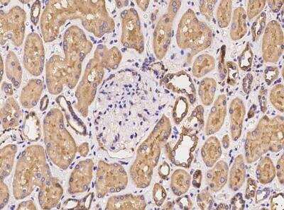 Immunohistochemistry-Paraffin: PACSIN2 Antibody [NBP3-06469]