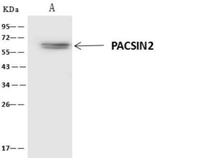 Immunoprecipitation: PACSIN2 Antibody [NBP3-06469]