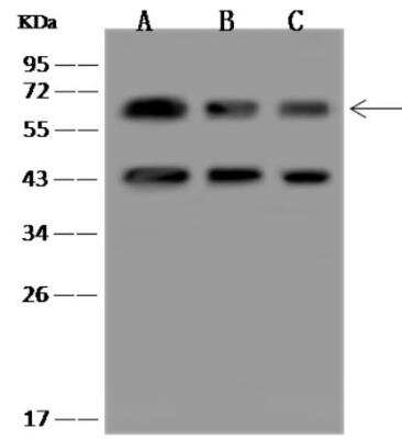 Western Blot: PACSIN2 Antibody [NBP3-06469]