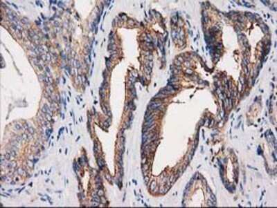 Immunohistochemistry: PACSIN3 Antibody (OTI4F8) - Azide and BSA Free [NBP2-73221]