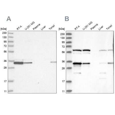 Western Blot: PACT Antibody [NBP2-55123]