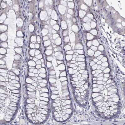 Immunohistochemistry-Paraffin: PADI1 Antibody [NBP2-37761]