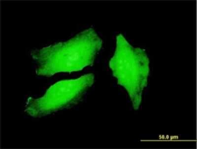 Immunocytochemistry/ Immunofluorescence: PADI4 Antibody (4D8) [H00023569-M01]