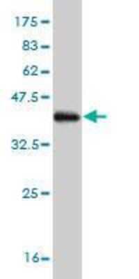 Western Blot: PADI4 Antibody (4D8) [H00023569-M01]