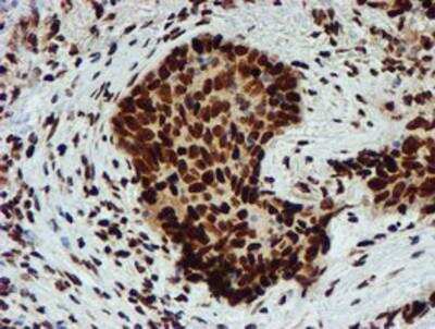 Immunohistochemistry-Paraffin: PADI4 Antibody (OTI4H5) [NBP2-02082]