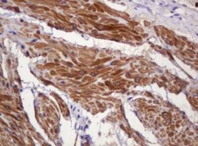 Immunohistochemistry-Paraffin: PADI4 Antibody (OTI5C10) [NBP2-46310]