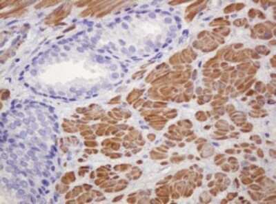 Immunohistochemistry-Paraffin: PADI4 Antibody (OTI5C10) [NBP2-46310]