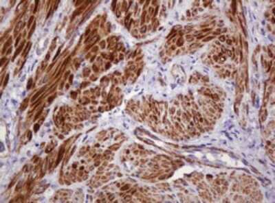 Immunohistochemistry-Paraffin: PADI4 Antibody (OTI5C10) [NBP2-46310]