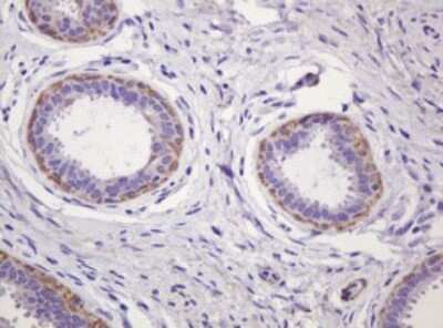 Immunohistochemistry-Paraffin: PADI4 Antibody (OTI5C10) [NBP2-46310]