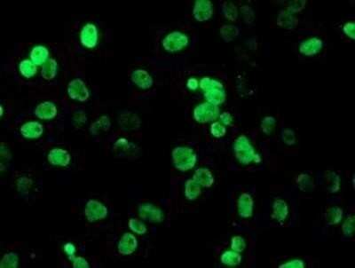 Immunocytochemistry/ Immunofluorescence: PADI4 Antibody (OTI4H5) - Azide and BSA Free [NBP2-73226]