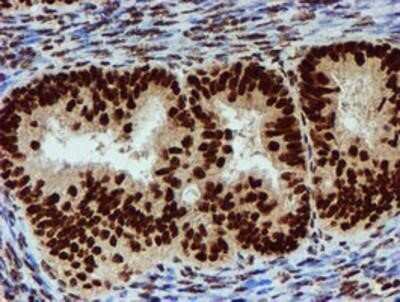 Immunohistochemistry: PADI4 Antibody (OTI4H5) - Azide and BSA Free [NBP2-73226]