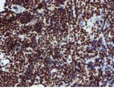 Immunohistochemistry: PADI4 Antibody (OTI4H5) - Azide and BSA Free [NBP2-73226]