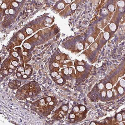 Immunohistochemistry-Paraffin: PAFAH1B2 Antibody [NBP2-13725]
