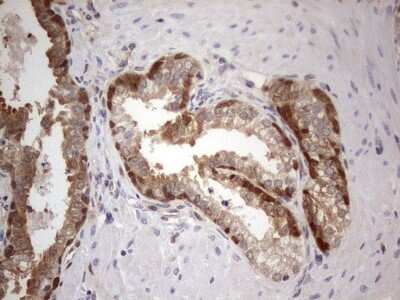 Immunohistochemistry: PAFAH1B3 Antibody (OTI5D2) [NBP2-46314]