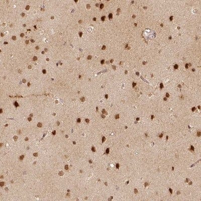 Immunohistochemistry-Paraffin: PAG608 Antibody [NBP2-62599]