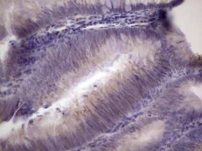 Immunohistochemistry: PAGE1 Antibody (OTI3E7) [NBP2-46315]