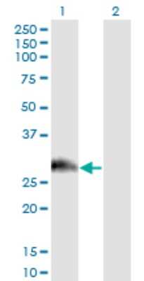 Western Blot: PAGE1 Antibody (6G6) [H00008712-M01]