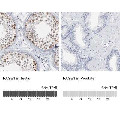 Immunohistochemistry-Paraffin: PAGE1 Antibody [NBP1-85414]