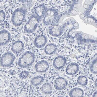 Immunohistochemistry-Paraffin: PAGE1 Antibody [NBP1-85414]