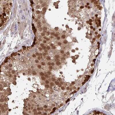 Immunohistochemistry-Paraffin: PAGE2B Antibody [NBP2-33657]