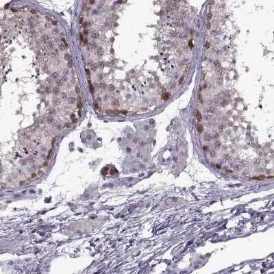 Immunohistochemistry-Paraffin: PAGE2B Antibody [NBP2-33657]