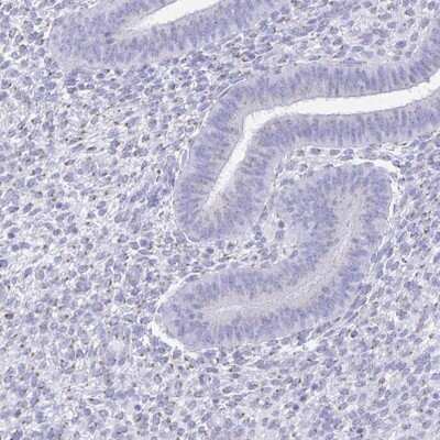 Immunohistochemistry-Paraffin: PAGE4 Antibody [NBP1-85413]