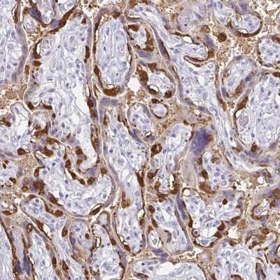 Immunohistochemistry-Paraffin: PAGE4 Antibody [NBP1-85413]